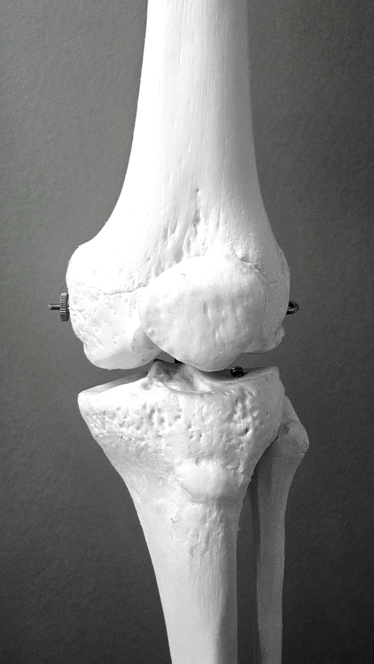 Bones – Joints – Osteoporosis