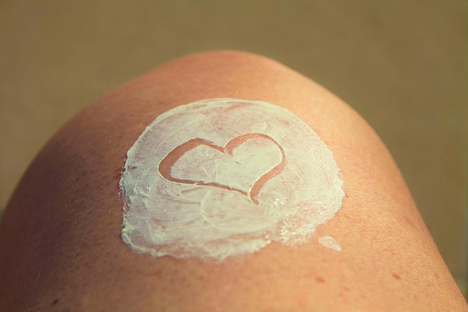 Burn Treatment