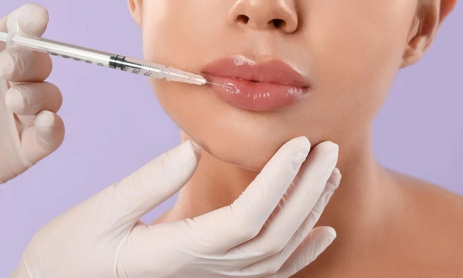 Fillers