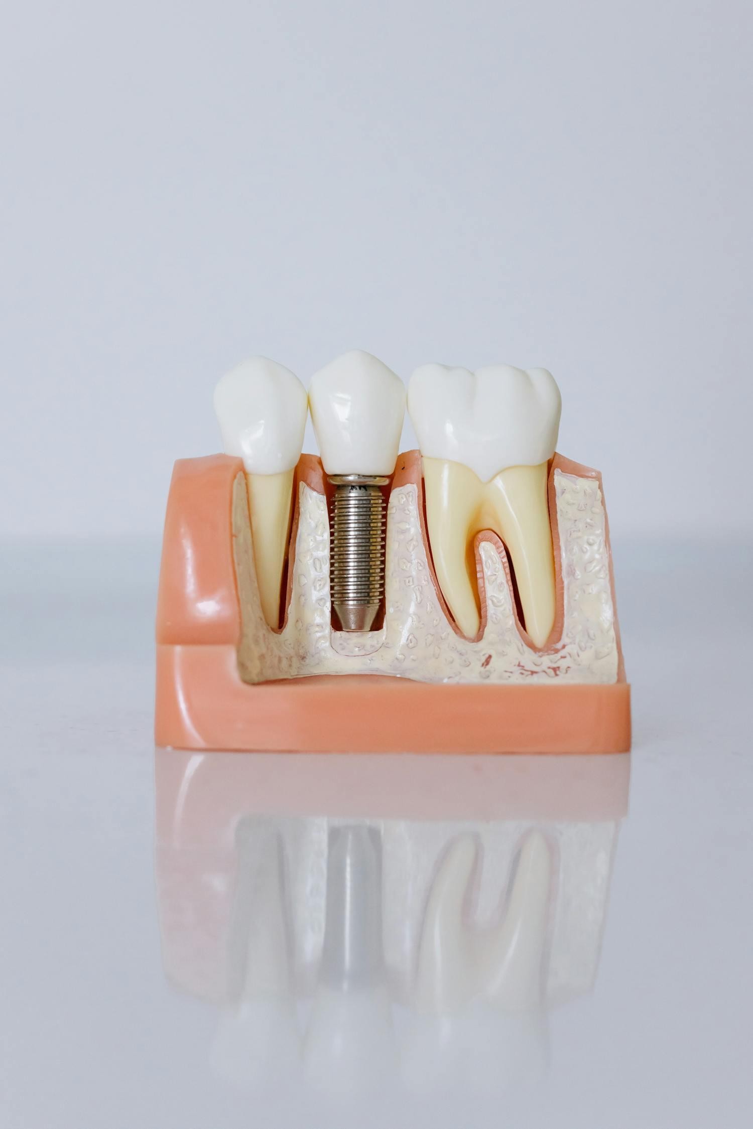 Dentures